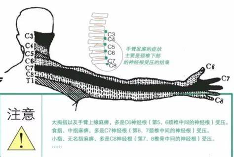 左胳膊发麻