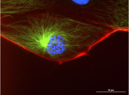 安捷倫BioTek分享提高細胞成像分析成功率上篇