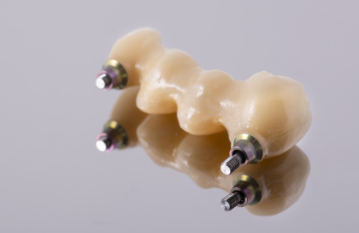 鼎植口腔联合诺贝尔种植牙发布福利活动：惠民种牙季