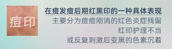 594eb9b424d70670b10d2df2c0872ef0.png