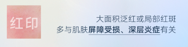 5b01e2b567d12a81cddfe70ace1bddb8.png