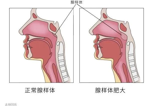 d50f6a3c6b85555c9abefda89d5a9f4d.jpg